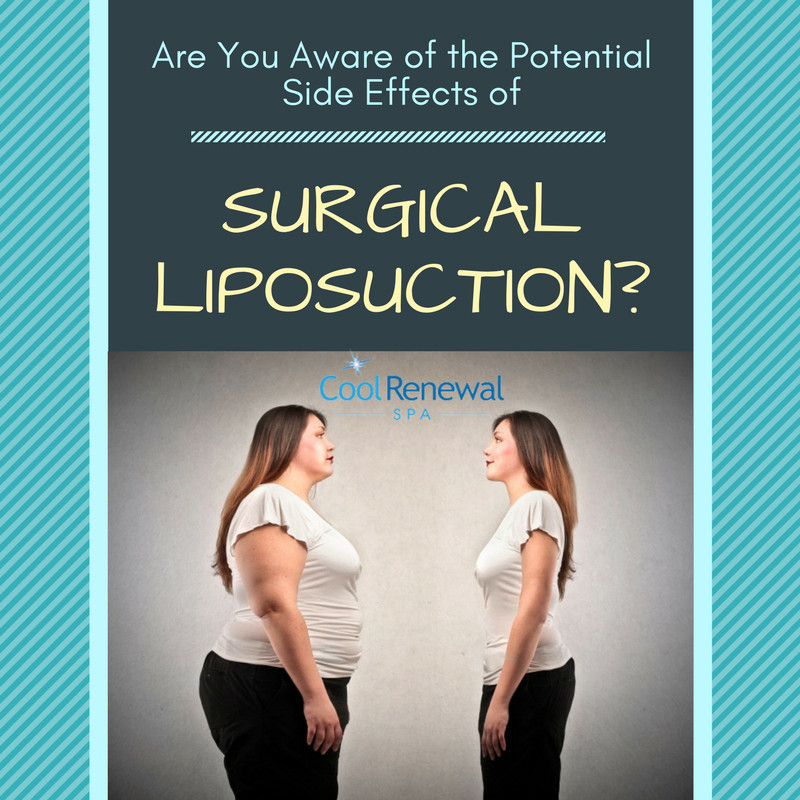 Are You Aware of the Potential Side Effects of Surgical Liposuction?