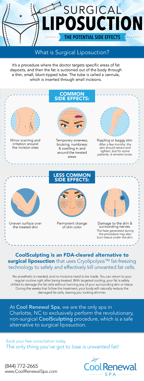 Are You Aware of the Potential Side Effects of Surgical Liposuction?