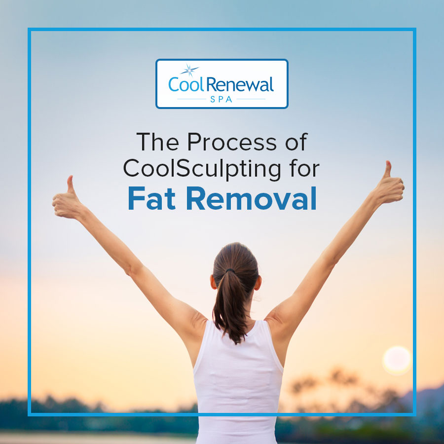 The Process of CoolSculpting for Fat Removal