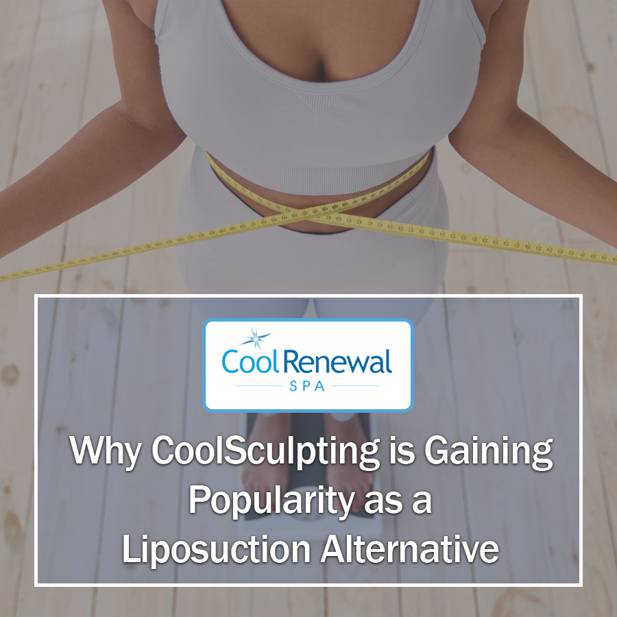 Why CoolSculpting is Gaining Popularity as a Liposuction Alternative